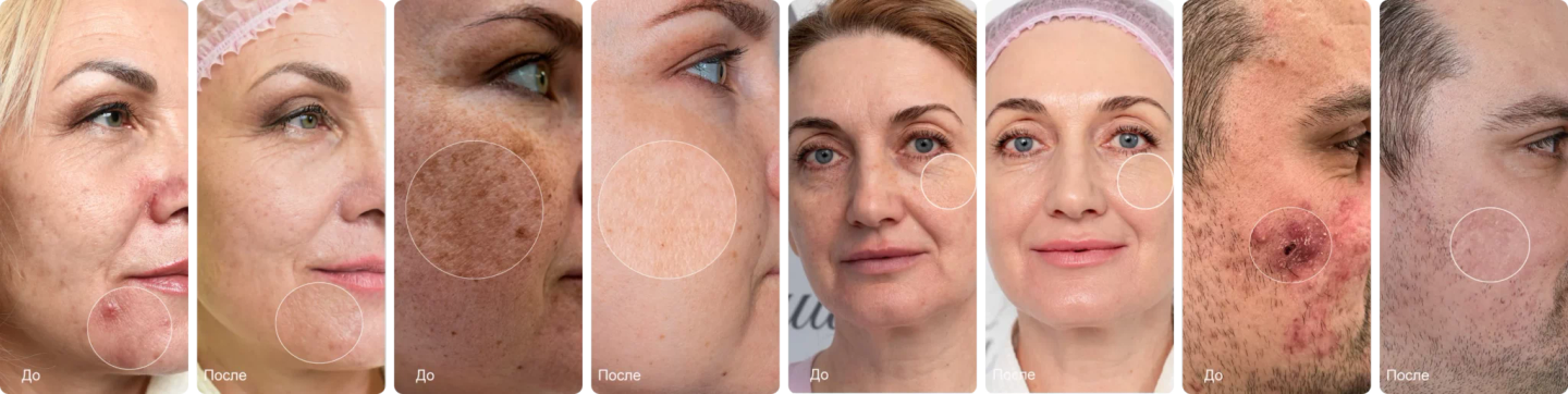 Преображение 1